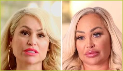 Darcey and Stacey Silva share footage as they undergo their latest cosmetic treatments